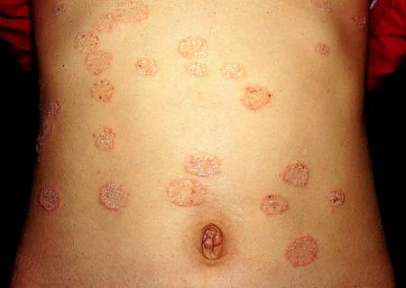 月經(jīng)不調(diào)是由什么原因引起的