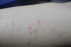 神經(jīng)性無(wú)痛引產(chǎn)的原因分析